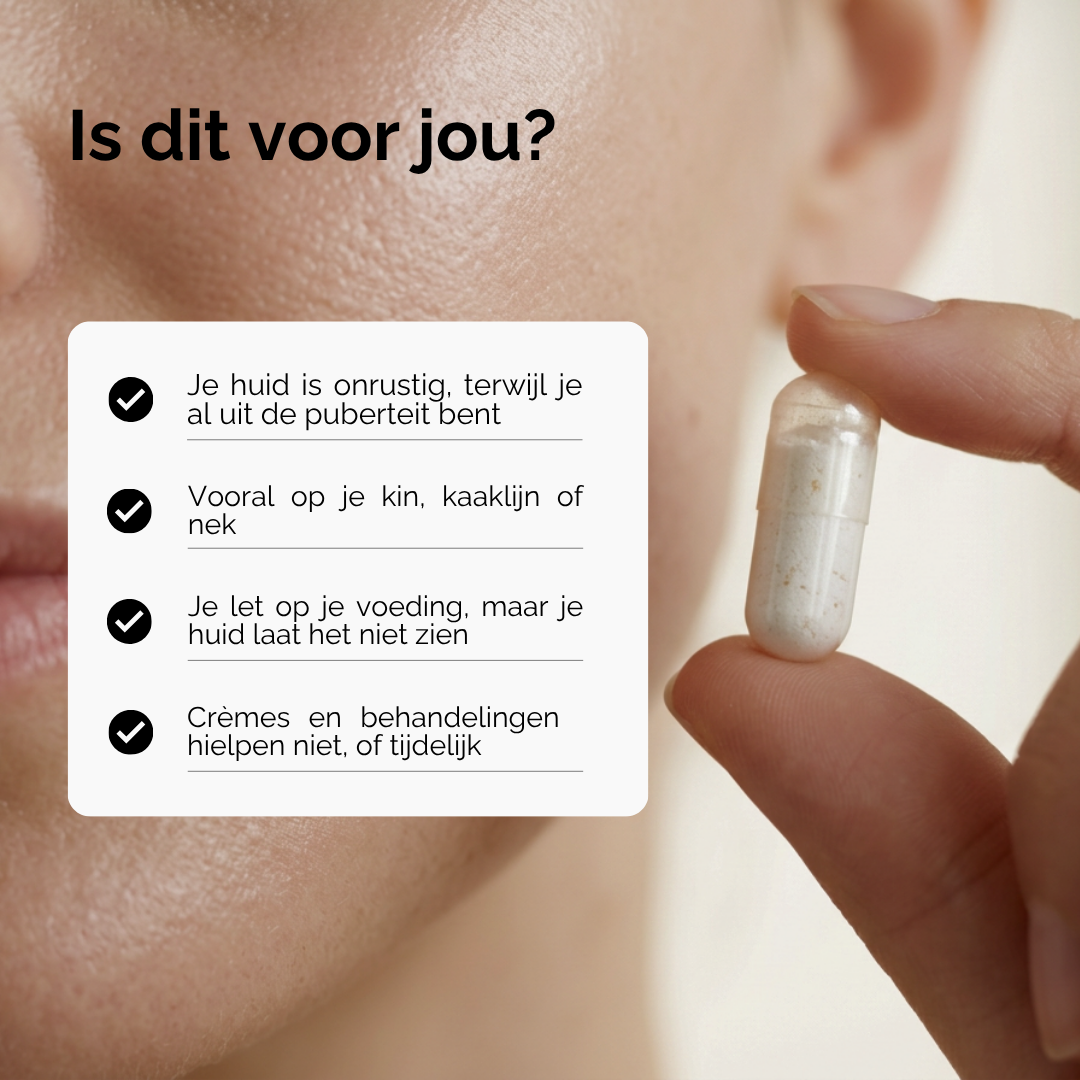 Skinie Huidformule is voor jou als je volwassen acne hebt of hormonale acne. Heb je acne die nergens op reageert is Skinie voor jou. Niets anders hielp tegen je acne, probeer dan skinie
